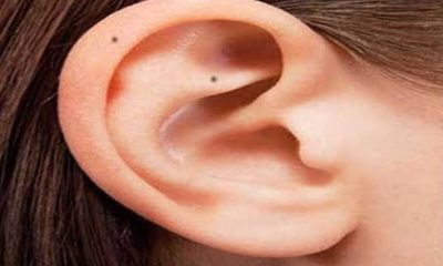 According to astrology, having a mole on the ear means this! Know complete information