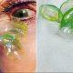 doctor-removing-23-contact-lenses-from-woman-eye