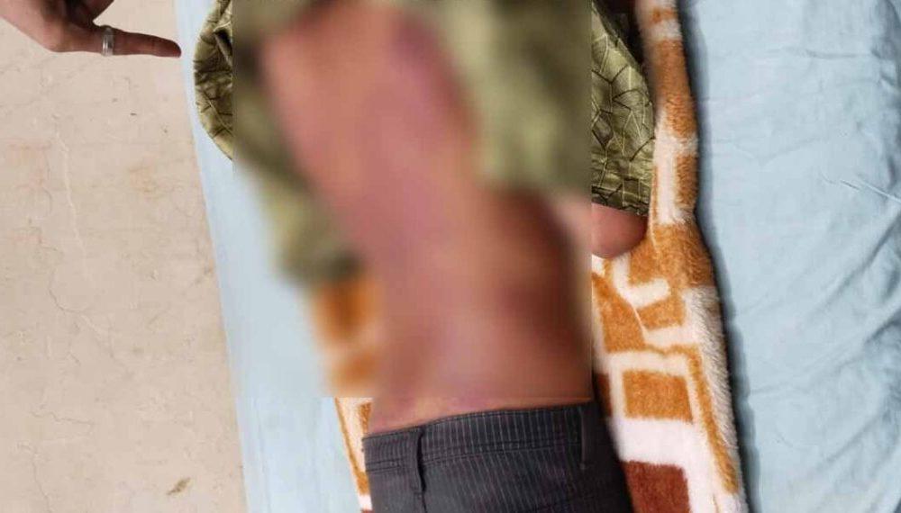 in-bhavnagar-the-organization-came-to-the-rescue-on-the-issue-of-beating-a-blind-student-will-meet-the-collector-tomorrow