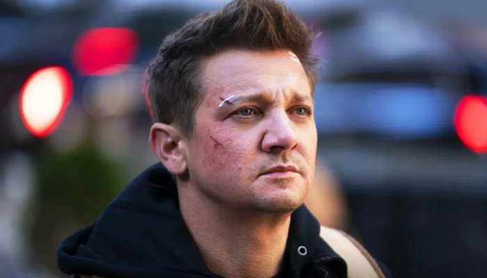 Jeremy Renner: Jeremy Renner shared the first photo from the hospital after surgery, showing many scars on his face