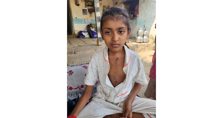 Successful operation of a girl from Chaya village of Ghogha taluka with congenital heart defect