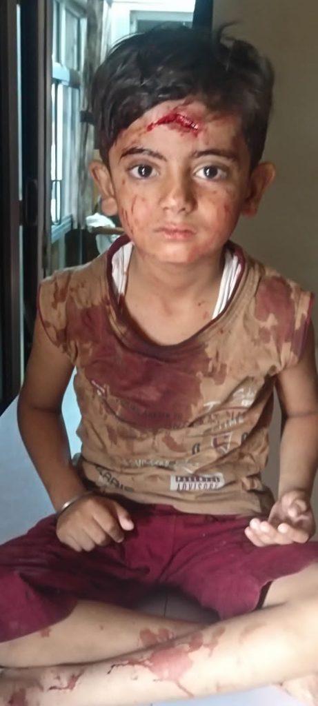 The precious life of a stray cattle; Stray cattle torture continues, seven-year-old child raped in Sindhi camp of Sihore