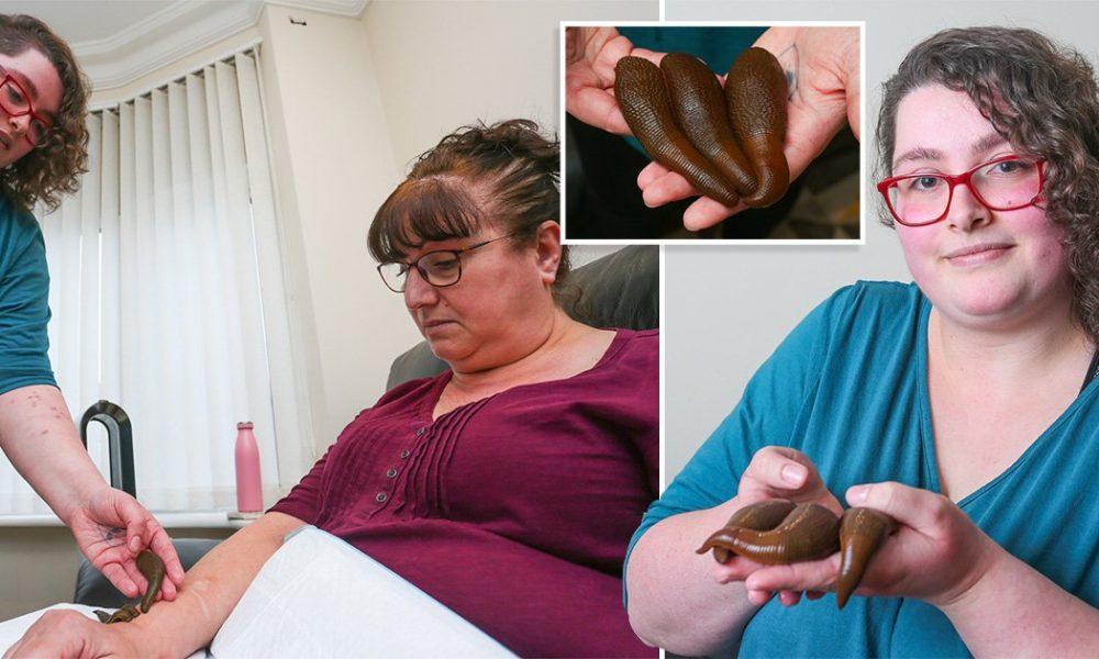 Oh no! Neither dog nor cat, woman keeps 35 leeches at home