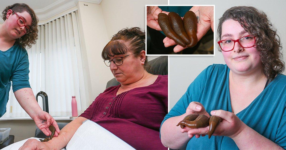 Oh no! Neither dog nor cat, woman keeps 35 leeches at home