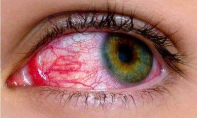 dont-be-afraid-there-will-be-no-problem-by-looking-into-the-eyes-of-the-infected-doctors