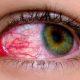 dont-be-afraid-there-will-be-no-problem-by-looking-into-the-eyes-of-the-infected-doctors