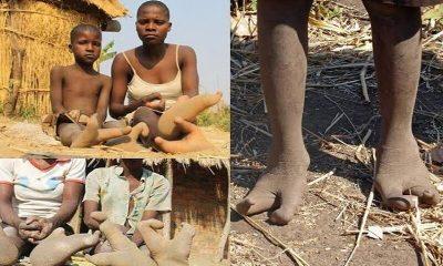 Face like a man and legs of an ostrich, the story of this community is mysterious! Feet have only 2 toes...